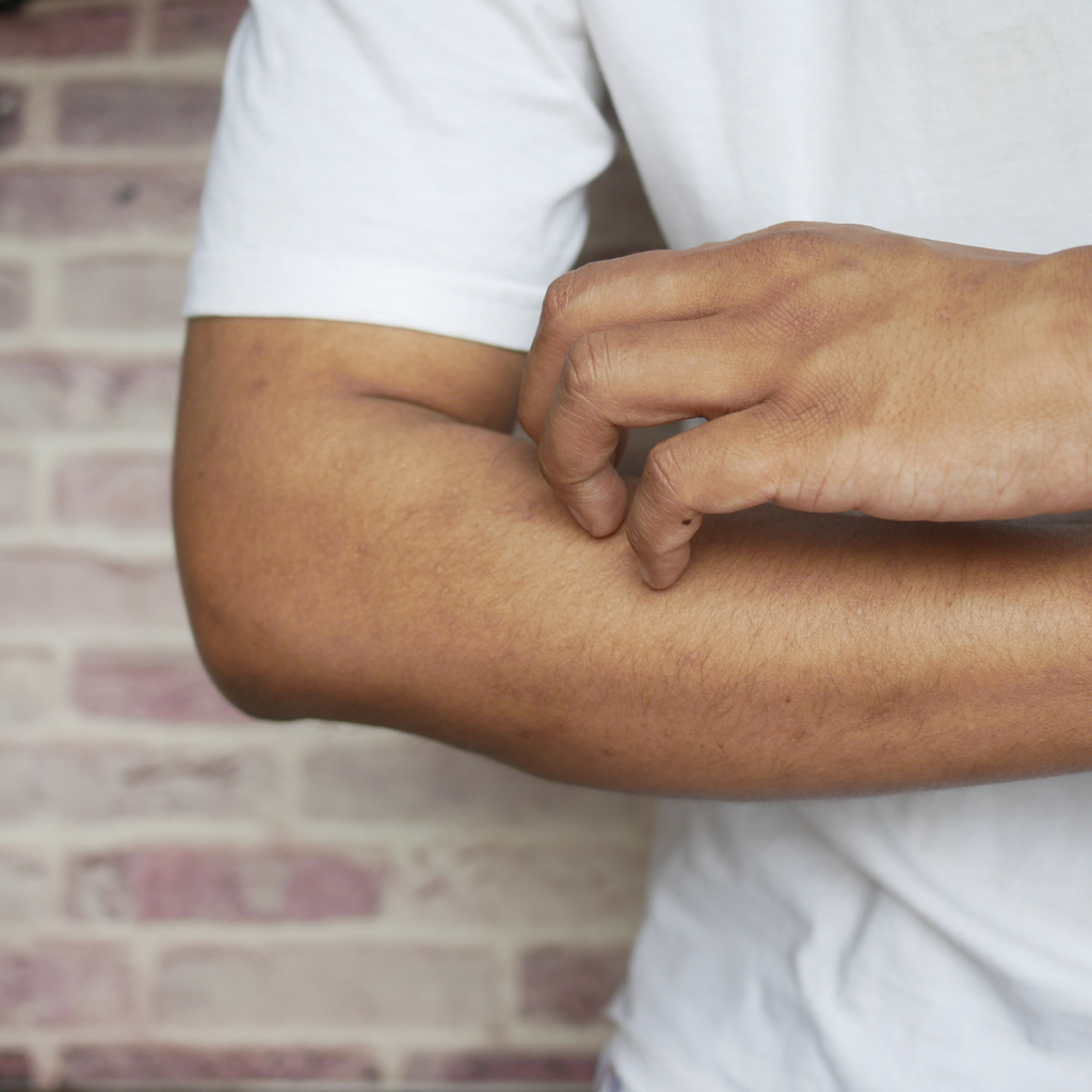 Part 1: Dry Skin - Five Causes of Dry Skin in Men